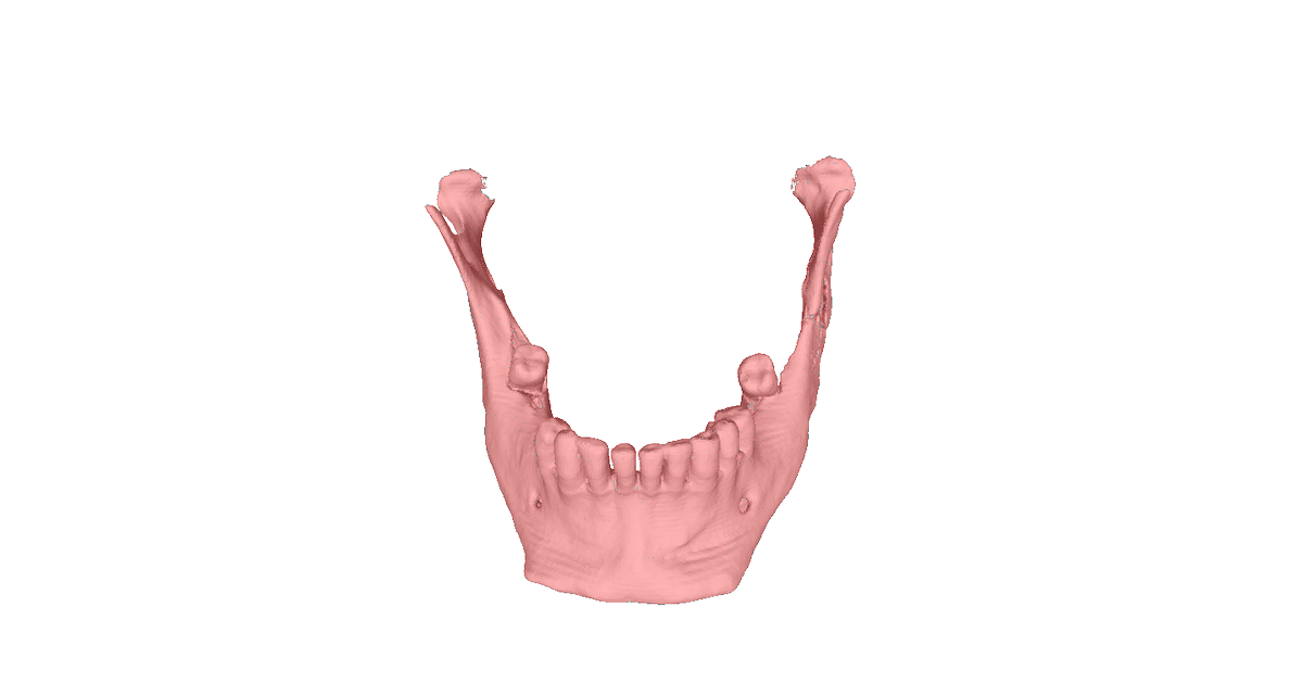 Printmed_3D's tweet photo. Are You interested in innovation for medicine &amp; innovation 3D printing for medicine? Follow us!! #3Dprinting #Printmed3D https://t.co/GQWNX0dxgG