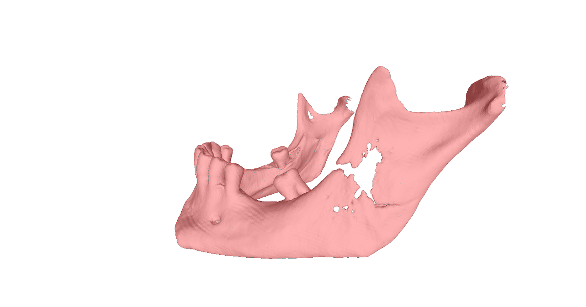 Printmed_3D's tweet photo. Are You interested in innovation for medicine &amp; innovation 3D printing for medicine? Follow us!! #3Dprinting #Printmed3D https://t.co/GQWNX0dxgG