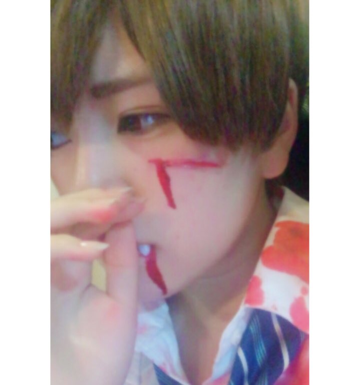 raito_1015's tweet photo. happyHalloween👻🍭🎃

傷メイクしてみました！
片目白コン入れてます🙄

#らぶりつください 
#ハロウィン 
#少しでも気になったらRT https://t.co/vByuhs0M08