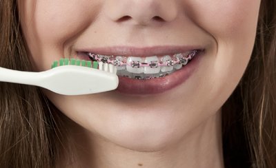 Olaat_Store's tweet photo. Elige cuidadosamente un cepillo de #dientes y asegurate de cepillarte bien alrededor y entre tus #brackets https://t.co/rWb85jIgSn https://t.co/ZEjIWQq4bf
