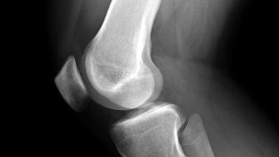 Charles_M_Russo's tweet photo. 3D Printed Hyperelastic Bone Is Like Duct Tape For Bone Surgeons #3dprinting https://t.co/Fm1ZGYEwOO https://t.co/EK7M8aywa3