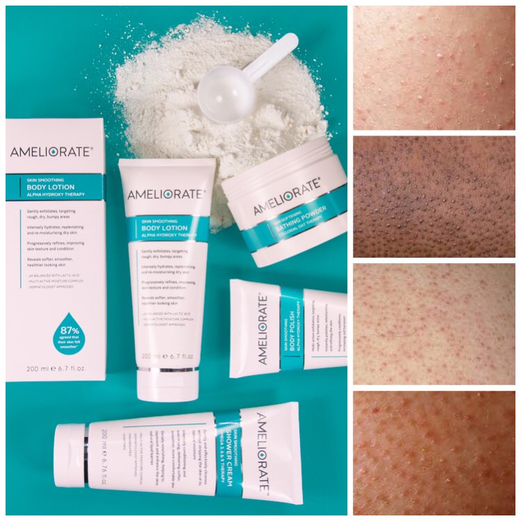ameliorateskin's tweet photo. Rough, dry bumpy skin? Try our award-winning range to resurface your skin.  #keratosispilaris #dryskin #bumpyskin #skincare #bodycare https://t.co/oziZXaTqs6