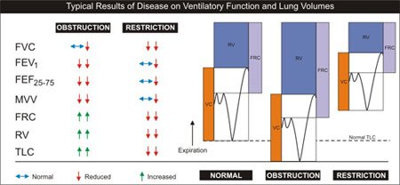 Obstructive Vs Restrictive Lung Disease Chart