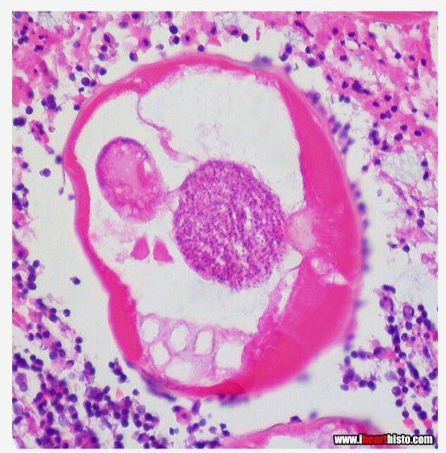 MarcelaSaebL's tweet photo. Got this in my TL #díademuertos 2 of November #patharts #pathology @JMGardnerMD @smlungpathguy https://t.co/ePmyEwAkDs