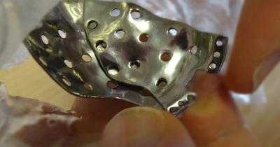 Charles_M_Russo's tweet photo. New 3D printing software allows surgeons to quickly design titanium facial implants https://t.co/fAEOYDoOW5 https://t.co/KPUIGhUEox