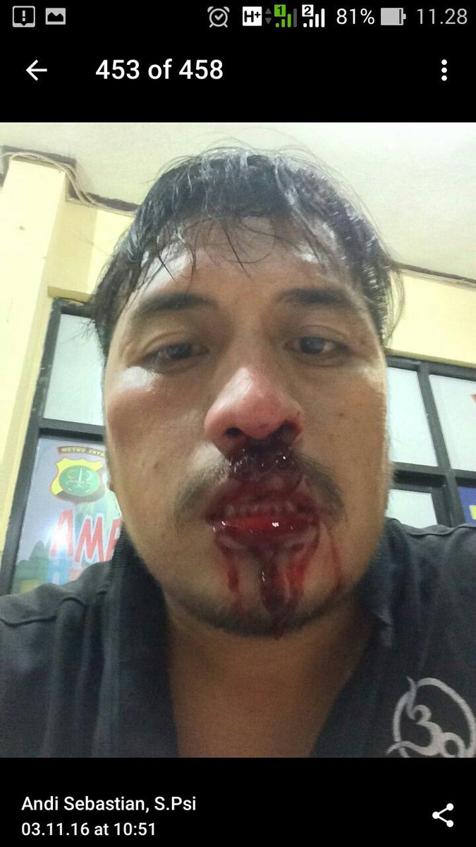 Taksi Online di pukulin Dishub DKI 
<a href="/kemenhub151/">Kemenhub RI</a> <a href="/AniesSandi4DKI1/">AniesSandi4DKI1™</a> <a href="/AhyCenter/">AHY CENTER</a> <a href="/basuki_btp/">Basuki T Purnama</a>