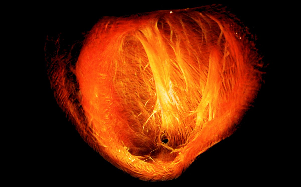 medimaging_cdt's tweet photo. Only 5 days til our Clinical Seminar with Dr Vivek Muthurangu https://t.co/aRqFOnLwrj #Cardiac #GOSH #Paediatrics #MRI #FastImaging https://t.co/S7Jesp1OR3