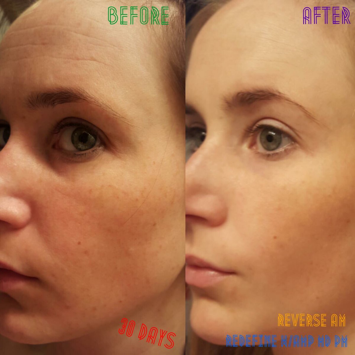 KTGreen6's tweet photo. Wow!! I love sharing Rodan and Fields products. 60 days using Redefine and Reverse. Bye bye skin damage and wrinkles #realresults #realpeole https://t.co/cAa1lqd9r5