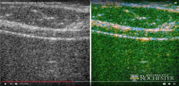 Ultrasound in color? It's real. And it's in Rochester. bit.ly/2ffJ2Lc