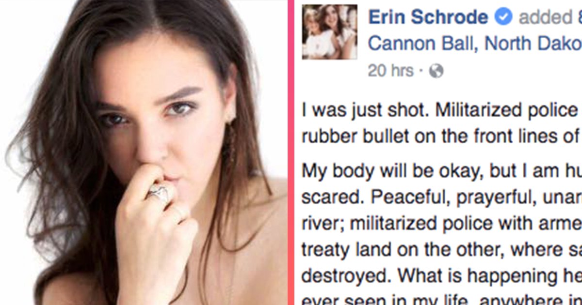 attn's tweet image. This white woman got shot at Standing Rock and has a strong warning for Pres. Obama. attn.link/2eZ2j5r