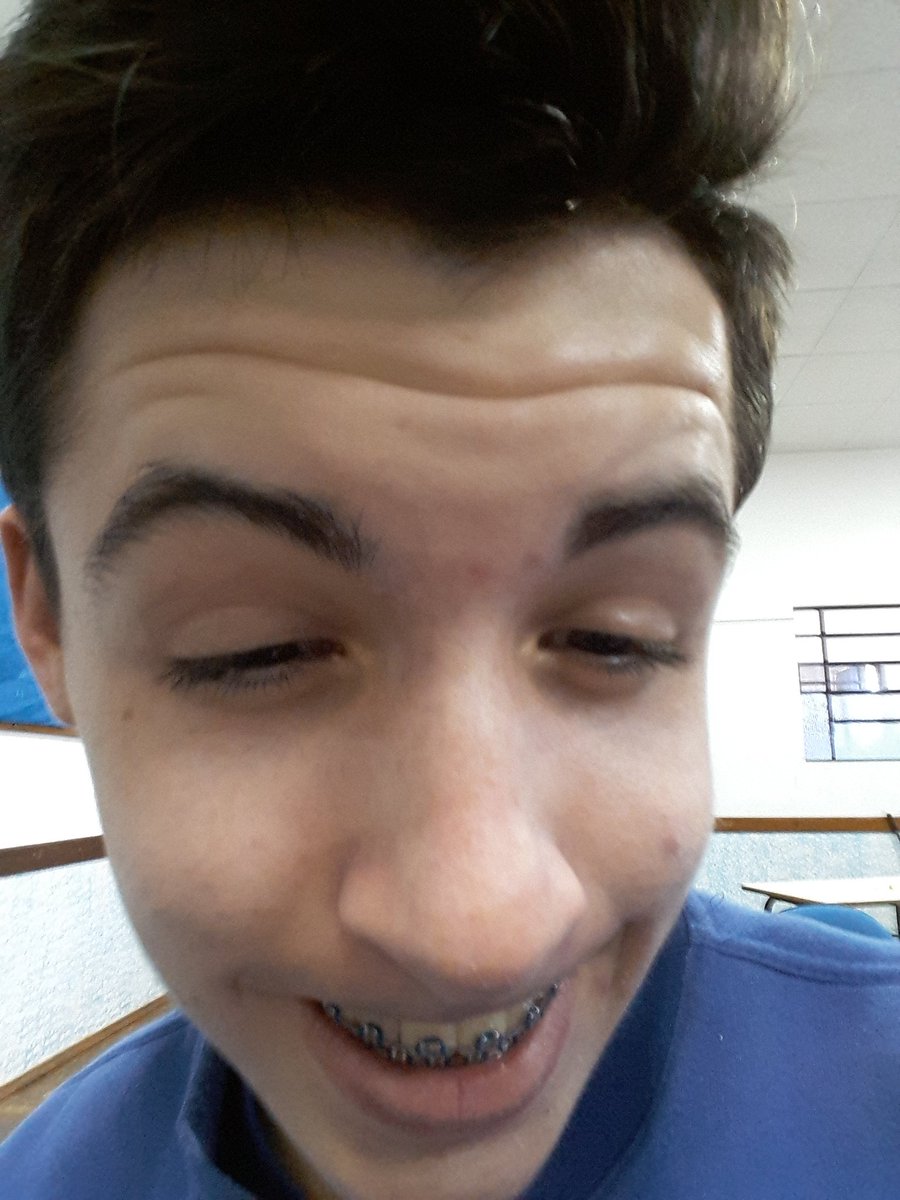 RomuloSawitsk's tweet photo. Outro amigo com down ajudem!! Isso tá se espalhado https://t.co/oIWxB8VQwh