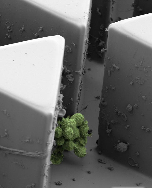 healalerts's tweet photo. Microchip captures clusters of circulating tumor cells ... https://t.co/swrURgwQdd https://t.co/PF80DjjB6w