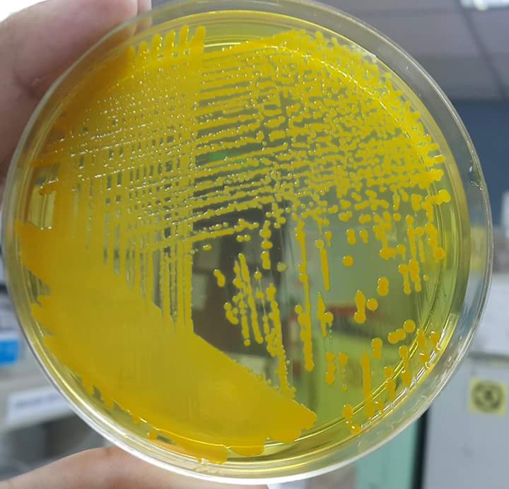 pgbact's tweet image. Vibrio cholerae on TCBS