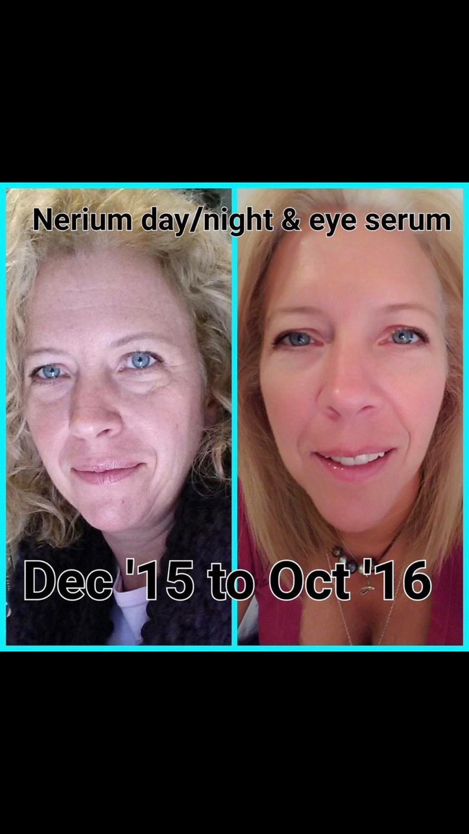 kmanningnerium's tweet photo. Real results from clients #nerium #WorkFromAnywhere #Australia #lexus #japan #entrepreneur #results #nophotoshop #yearsyounger #healthyskin https://t.co/Zzqbdcq0Ma