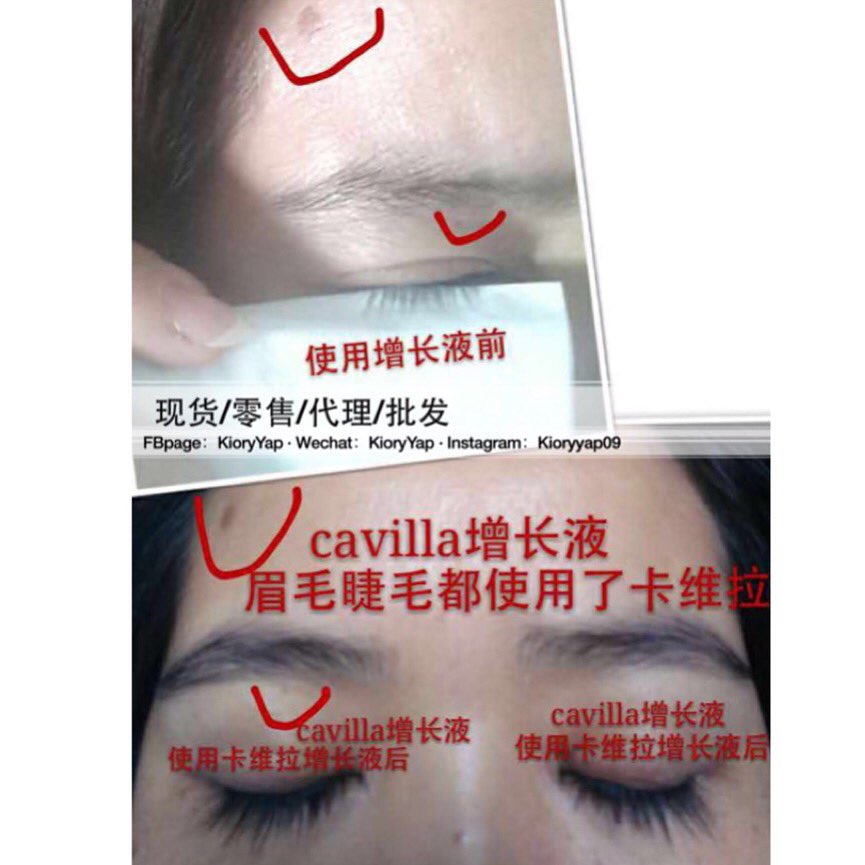 cavilla_'s tweet photo. 🎊🎊🎊客户宝贝反馈➕1⃣️
好产品自己会说话，不用解释👍👍👍
#Cavilla睫毛增长液 #cavilla #卡维拉 #睫毛增长液 #睫毛增长 #睫毛 #增长液 #增长 #长睫毛 #浓睫毛 #眉毛 #头发 #秃头 #自然生长 #现货供应 #招商 #现货 #零售 #代理 #批发 https://t.co/jbPvRACRGu