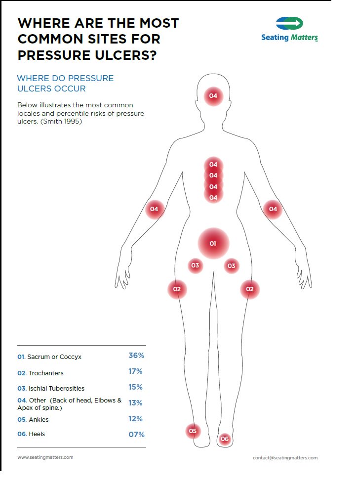 SeatingMatters's tweet photo. Pressure must be redistributed off vulnerable bony prominences to prevent #pressureulcers developing #skininspection is key #stopthepressure https://t.co/9G29XKSAgV