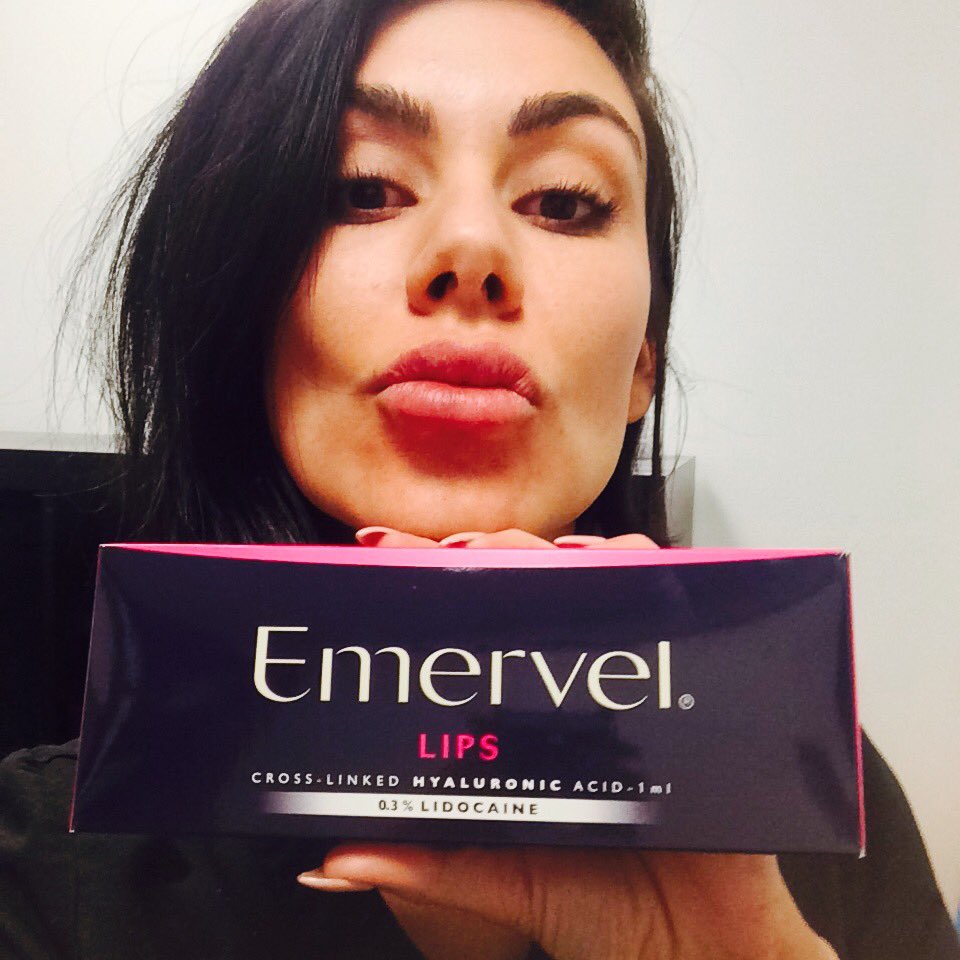WestsideLaser's tweet photo. Maggie from our team at Westside is loving the results of her Emervel treatment. #staffrecommendation #lips #cosmeticinjections https://t.co/cXZuq0UZ0F
