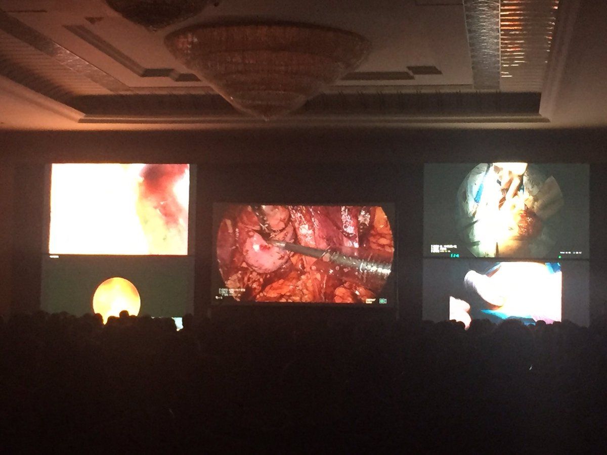 claudiagonalfa's tweet photo. #LiveSurgery desde #cua2016 #china #tianjin #urology #PN #oncology #endourology https://t.co/g6nS61xPbd