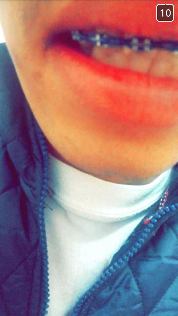 منن يبي يمص شفٱتي لينن يصبب ٱلدم..😴💕