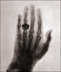 Shoulderfolder's tweet photo. This is the first ever X-Ray, taken by physicist Wilhelm Röntgen in 1895 showing his wife's left hand #throwback https://t.co/Y88mKVX6Ui