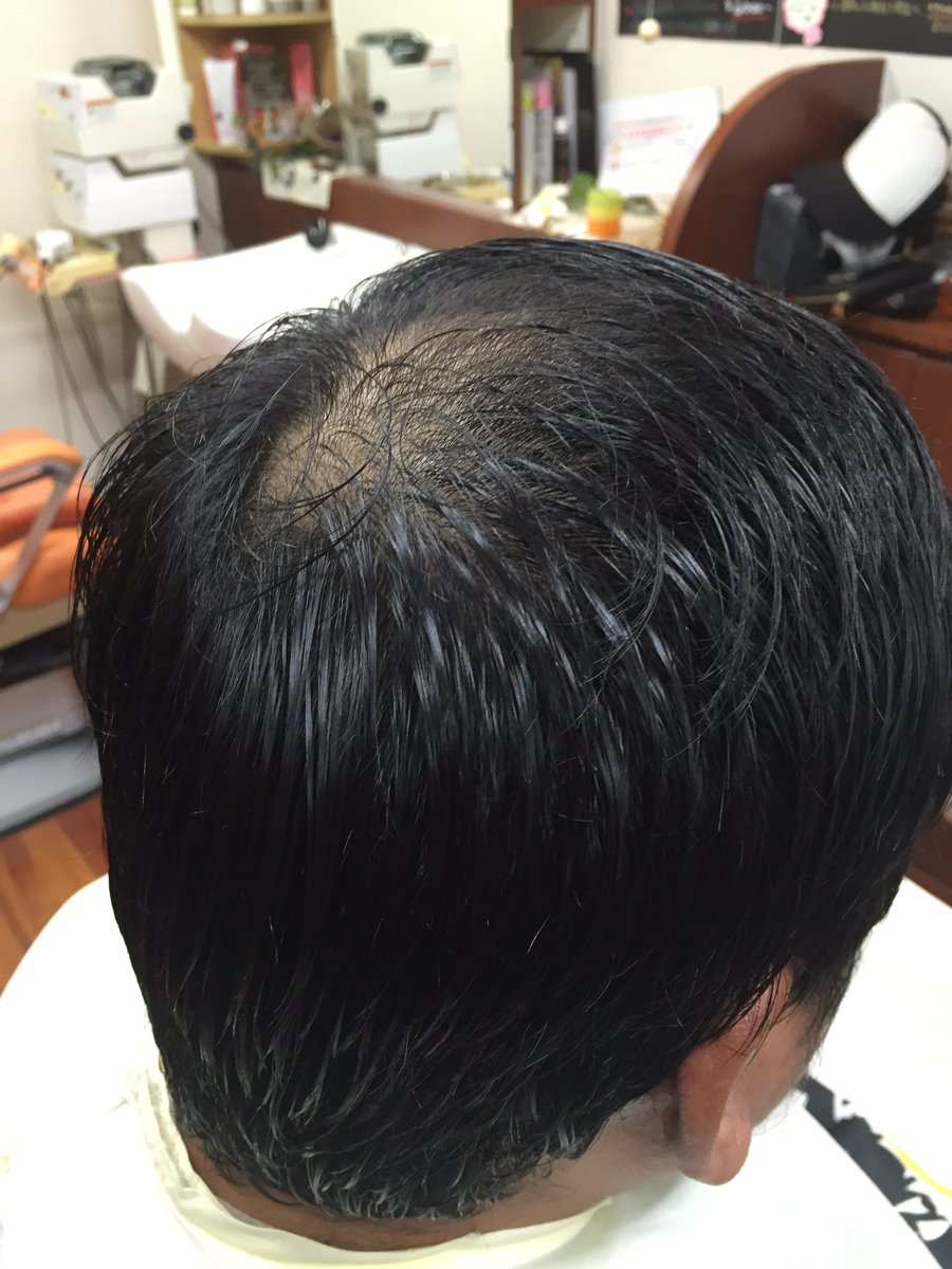 Hair Salon Kurisu U Tvitteri 薄毛が気になる30代からの男性は薄毛用のヘアスタイルに変更することをオススメします 薄毛が気になるから長く伸ばすのはやめましょう 薄毛 ヘアスタイル 抜け毛 生え際 育毛 大東市 理容室 メンズ メンズ専門美容室 30代