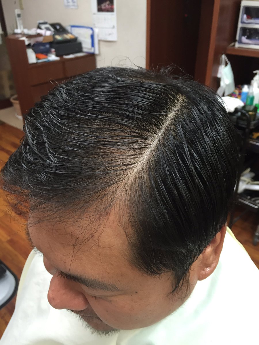 Hair Salon Kurisu U Tvitteri 薄毛が気になる30代からの男性は薄毛