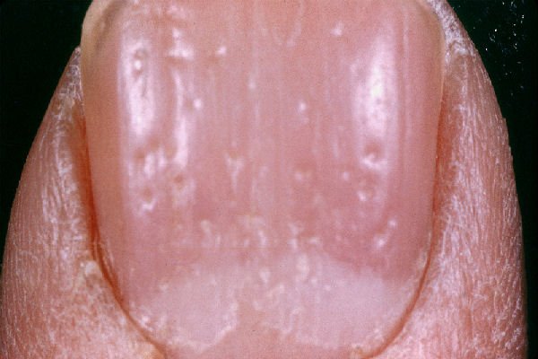 Common Nail Issues and How to Fix Them