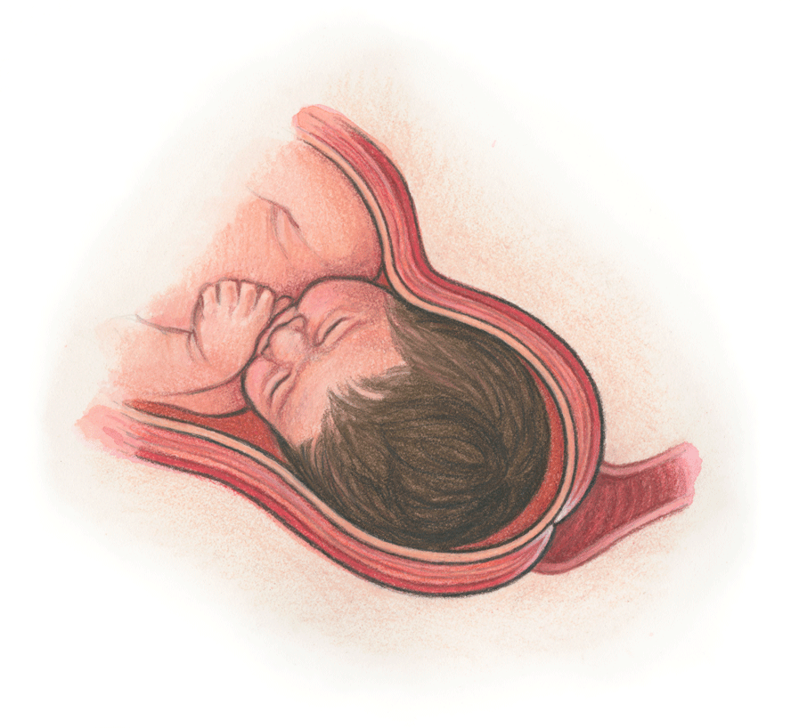 thebirthbook's tweet photo. For the #cervix to dilate, it must thin &amp; soften. This is called #effacement. https://t.co/ddn5qVQoDq https://t.co/NaUi31aEJG