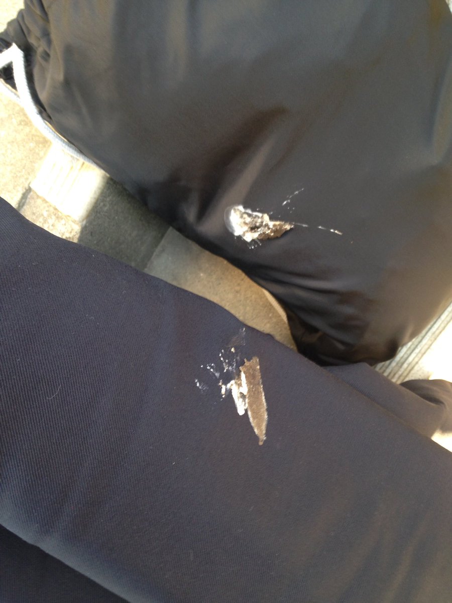 ao412el's tweet photo. まさかのブレザーに鳩フンはもうなんかありがとうて感じだよね。
もものusaバックにもついてるおそろっち❤︎ https://t.co/b9kVVpL700