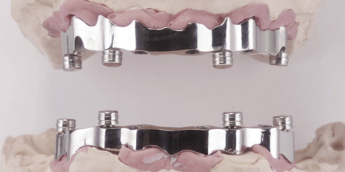 dentistriversid's tweet image. RT  RT  Clinical case by Mdt Elekes Zoltan Dtg -Romania! #implanto…