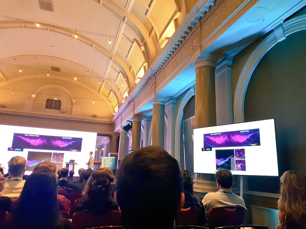 BeckiePort's tweet photo. Loving the images in Dr Dodson's presentation on disruption of dopamine neuron signalling, the science is just as beautiful! #PDconf2016 https://t.co/nGhL6Akcjp