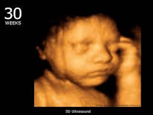 NotKennyRogers's tweet photo. I've yet to hear a convincing argument as to why any Christian would be okay with a president who doesn't believe this is a life: https://t.co/ZQSIaxEZLe