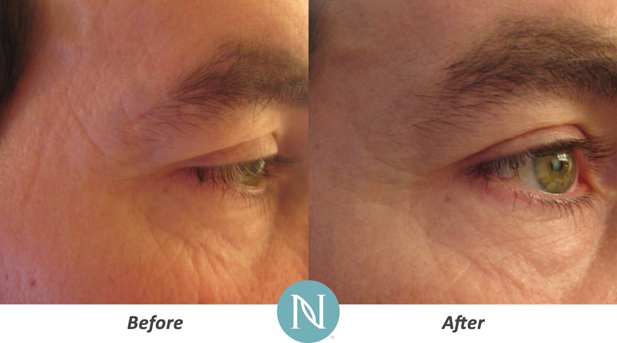 neeter1968's tweet photo. Nerium Age-Defying Cream offers the possibility to wake up feeling and looking your best. https://t.co/XNtbfbQ3e7 https://t.co/oV4oVycr2Y