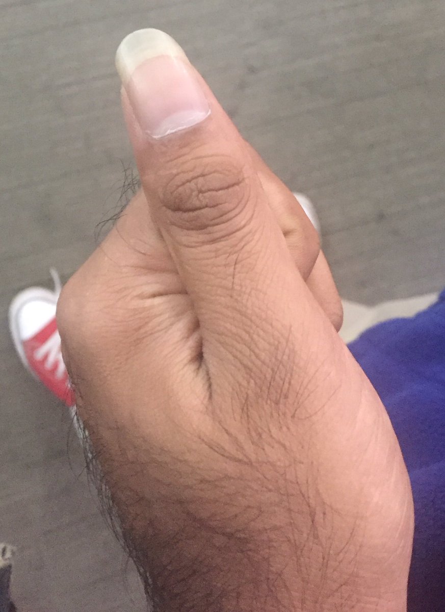 _sayema's tweet photo. So I hv never really understood why so many boys have this ONE nail uncut! They refuse to let it out too :( #QueryOfTheDay https://t.co/85WKNVicfU