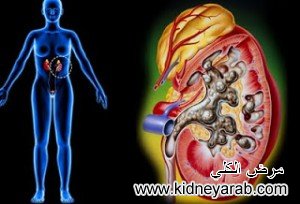 RenalHealthy's tweet photo. الكبيبي و نسبة  الكرياتين7.8: كيف يتجنب غسيل الكلي https://t.co/k2ZymYTmvc
