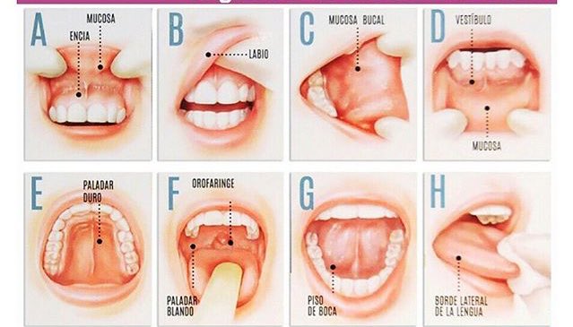 Pasos para detectar el Cáncer Oral

 👉🏻 youtu.be/q3zboJNO8t8