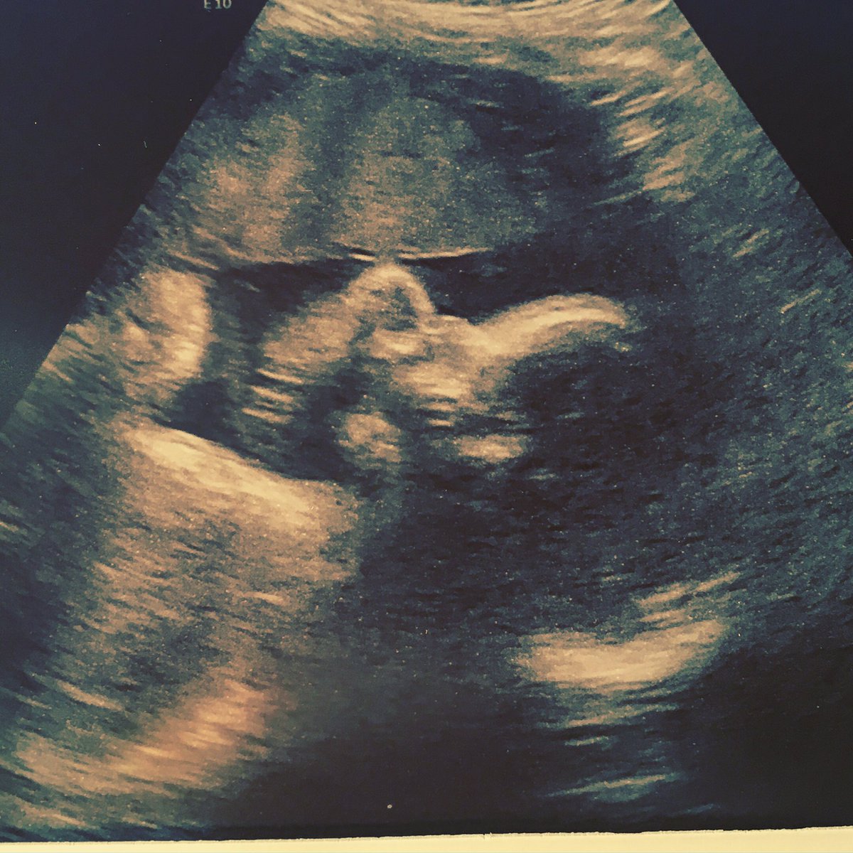 LAURAAMY89's tweet photo. #7weeks until I'm a #mummy #mummydiaries 😍😍😍 can't wait to meet him! 👶🏾💙 https://t.co/wF5M45CeZZ