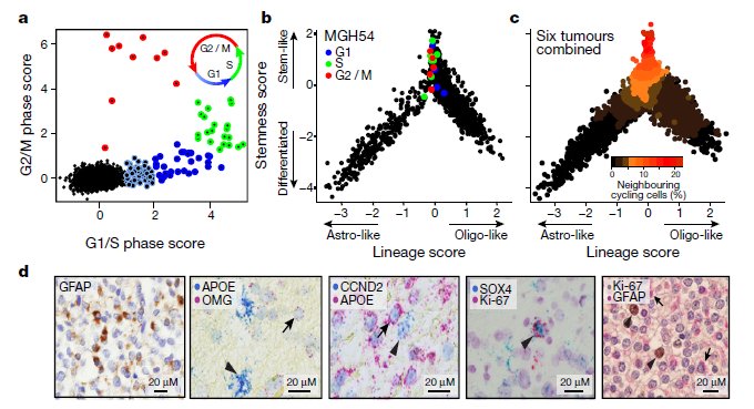 NaturePortfolio's tweet photo. Single-cell RNA-seq in human gliomas identifies cycling cancer stem cells &amp; their glial-like cell progeny https://t.co/MKtlqhCDcb https://t.co/BSDNxoWQla