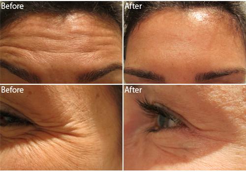 Timeless_Skin's tweet photo. Timeless Skincare has a specially designed procedure for #LaserHairRemovalForDarkSkin. Browse through our website. https://t.co/BTTyqFpZ6s https://t.co/xJ1mQ3O58O