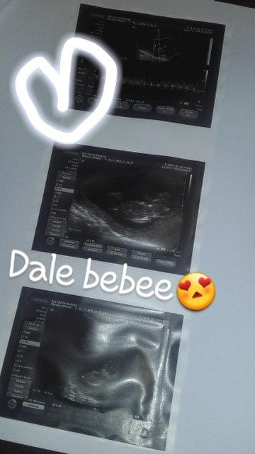 agus02348191's tweet photo. Apurateee😍❤ https://t.co/2OS52NY36m
