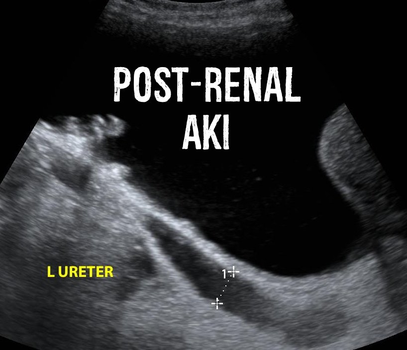 Hennepin Ultrasound tweet media
