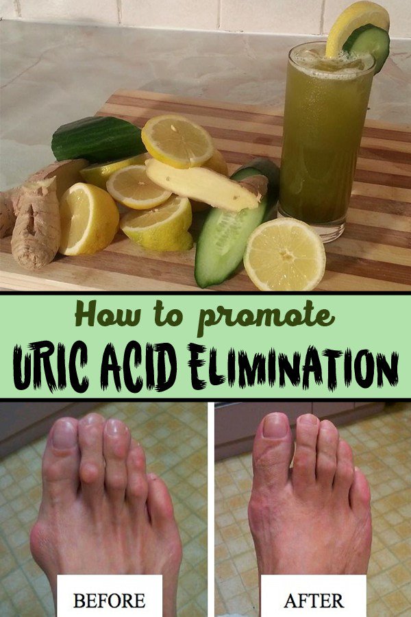 flexadrin's tweet image. How to promote URIC ACID Elimination...

facebook.com/flexadrin/