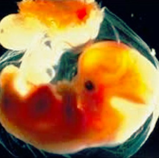 xSenseLabs's tweet image. #TT Pic:IGer @Nitin.Bose: #xSense scents work via some #brainpathways that form in an embryo, by age 3 has 2X as many synapses as adults?!