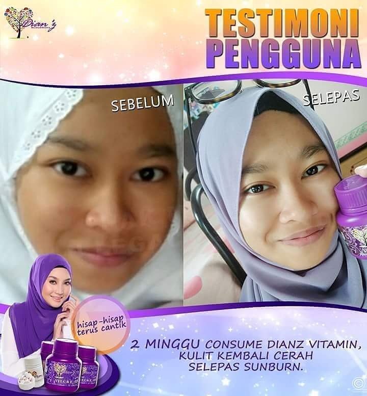 hakakcute's tweet photo. Sedih bila balik holiday kulit sunburn kan? Sis ni consume DV dlm 2 minggu kulit makin cerah dah, Alhamdulillah 👏 https://t.co/IQ7ptggWZJ