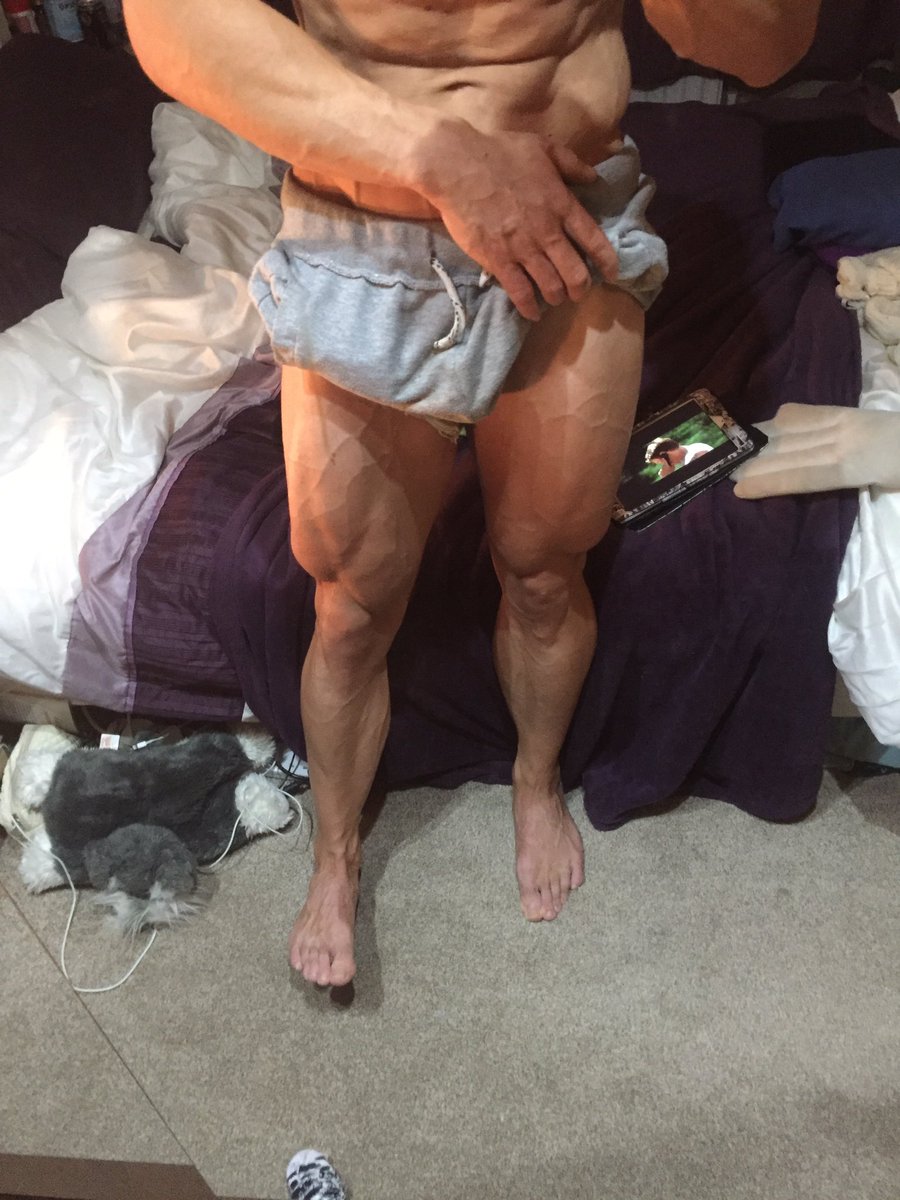 All about the leg veins ...