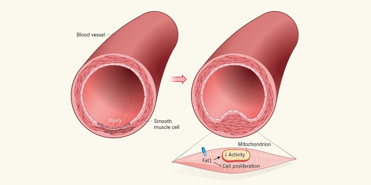 Nature News & Views on Twitter: "Mitochondria regulate smooth-muscle cell  proliferation in blood-vessel repair (£) https://t.co/HaMICW4bL9  https://t.co/mOcdryC0LF" / Twitter