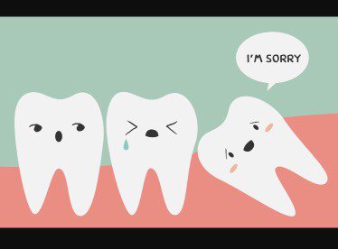 TheBloggerBee's tweet photo. Fuck off wisdom teeth.  https://t.co/rkDSTOax8v https://t.co/3XI7fhf2Br