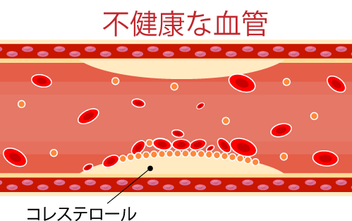 血管のtwitterイラスト検索結果 古い順