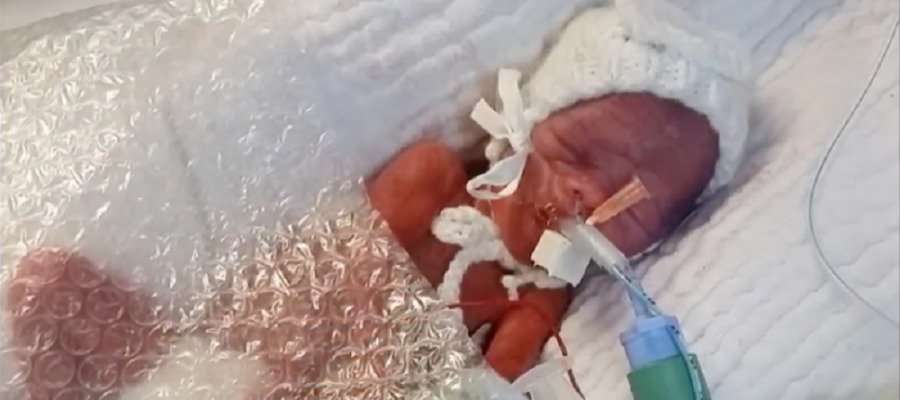 A3Noticias's tweet photo. FOTOS | Dos gemelos prematuros sobreviven gracias a una envoltura en plástico de burbujas https://t.co/PWYeYZKhjm https://t.co/YEDon35zGq