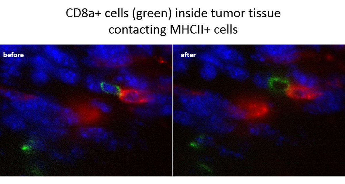bioSyntagma's tweet photo. Before and after photos showing cell ablation in-situe localization of Tcell (green) &amp; APC's (red).  NA sent for expression analysis. https://t.co/KOo1SQz2op
